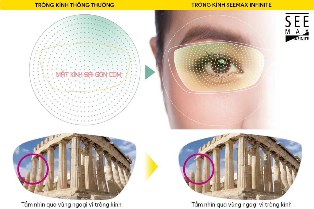TRÒNG KÍNH CÁ NHÂN HÓA THỊ GIÁC NIKON SEEMAX INFINITE - Hình 3